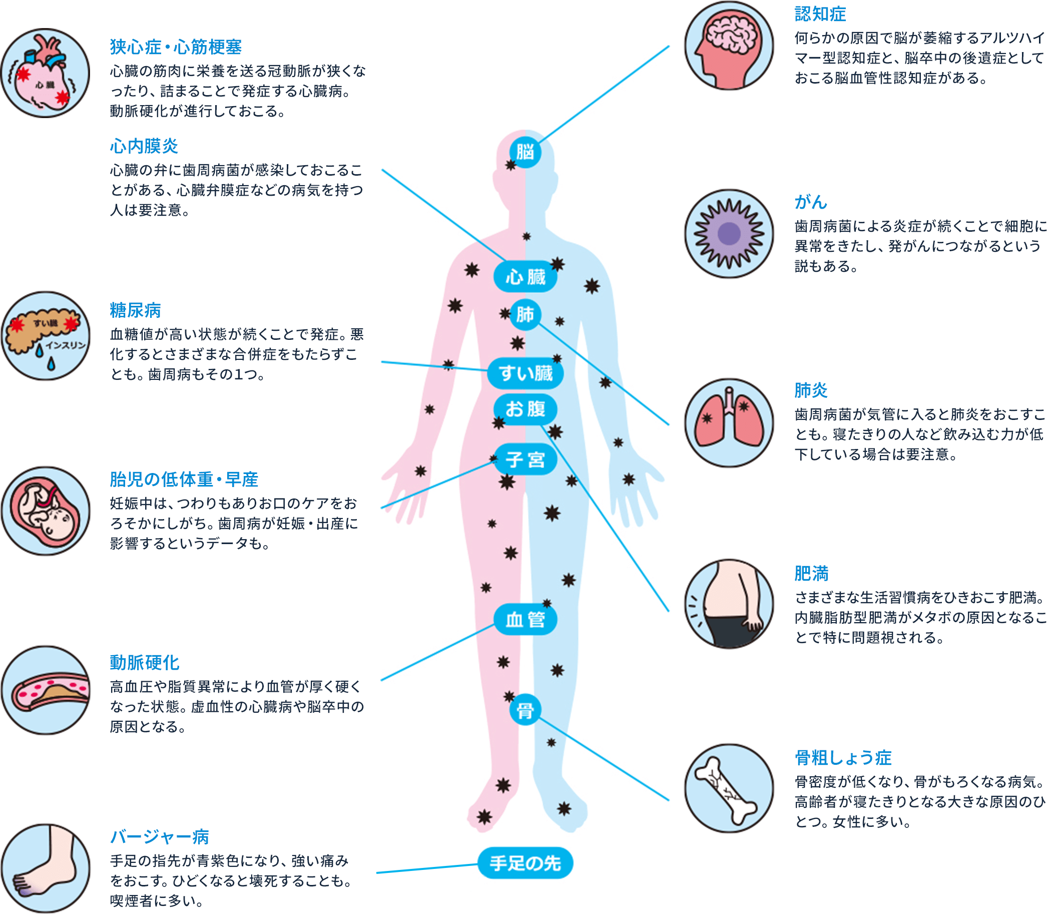 狭心症・心筋梗塞 心内膜炎 糖尿病 胎児の低体重・早産 動脈硬化 バージャー病 認知症 がん 肺炎 肥満 骨粗しょう症